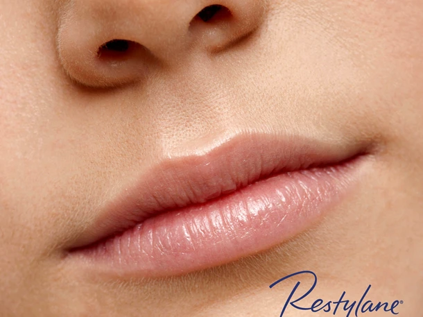 Fillerbehandling av lepper