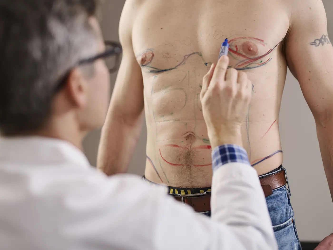 Konsultasjon vaser liposkulptur